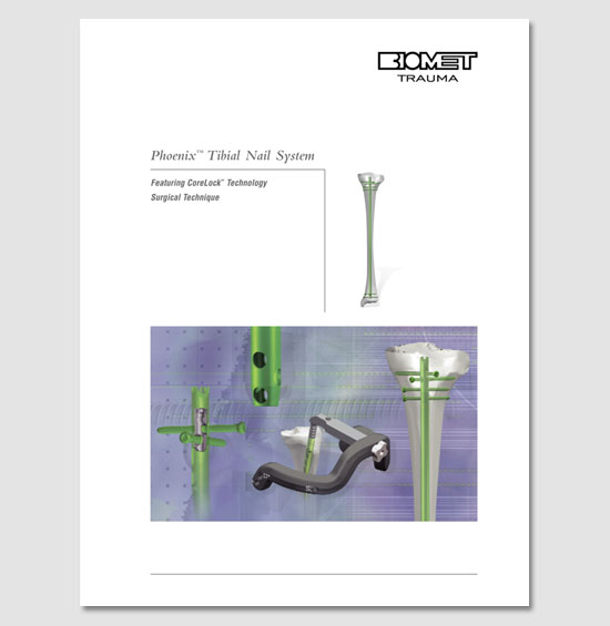 Biomet Tibial Nail